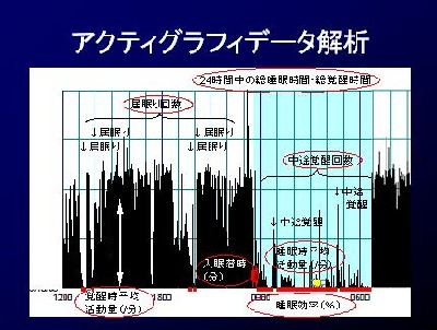 アクティグラフデータ解析