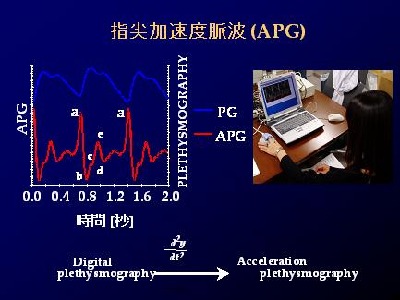 指尖加速度脈波